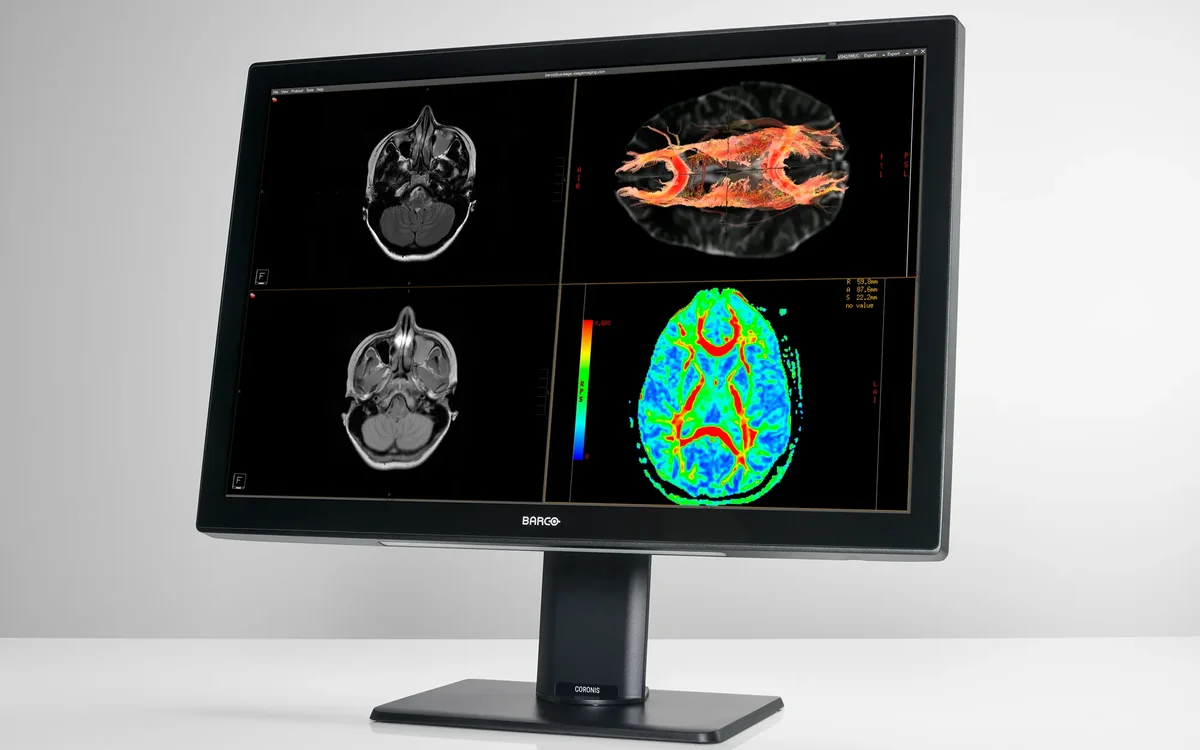 Barco Coronis Fusion 6MP diagnostic display